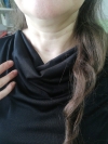 PARATİROİD ADENOMU AMELİYATI ZOR MU?